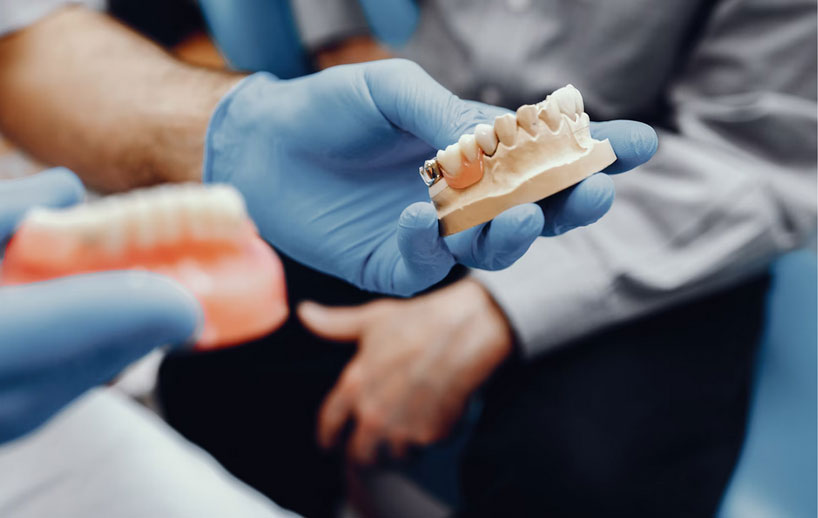 dental-crown