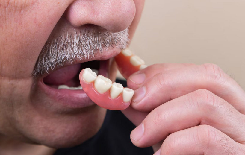gum-disease