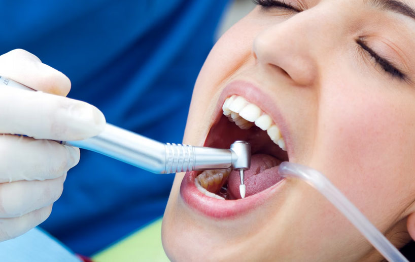 root-canal