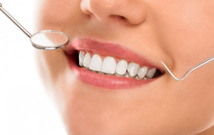 tooth-whitening