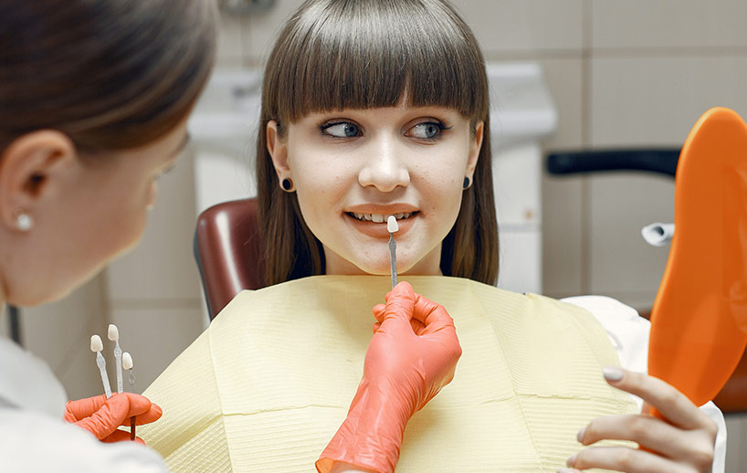 veneers